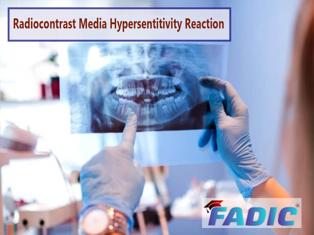 Radiocontrast Media Hypersensitivity Reactions