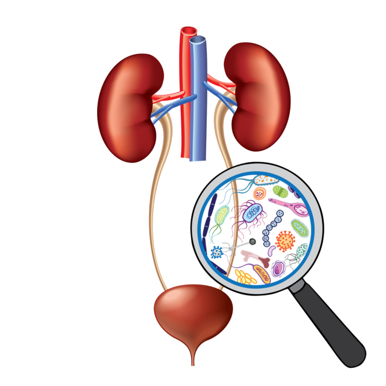 uti-management-course-stewardship-for-optimal-treatment