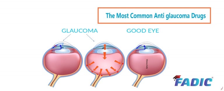 Anti Glaucoma Drugs Commonly Used