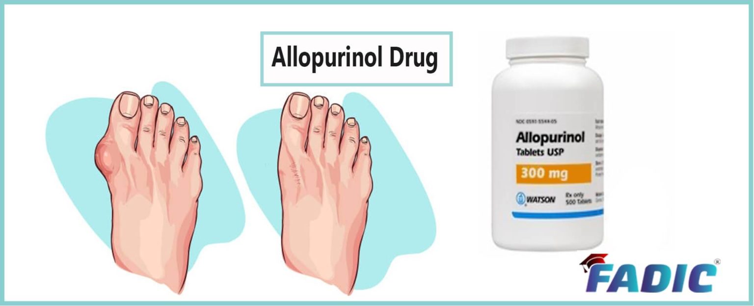Allopurinol Oral Uses Side Effects Interactions Warnings allopurinol-oral-uses-side-effects-interactions-warnings