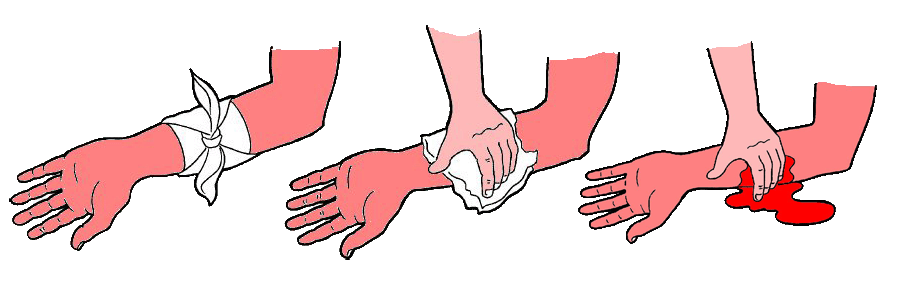 الاسعافات الأولية