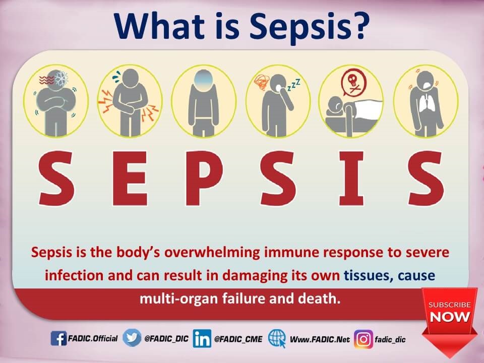 Septicemia Or Sepsis Causes, Symptoms, Signs, Diagnosis And