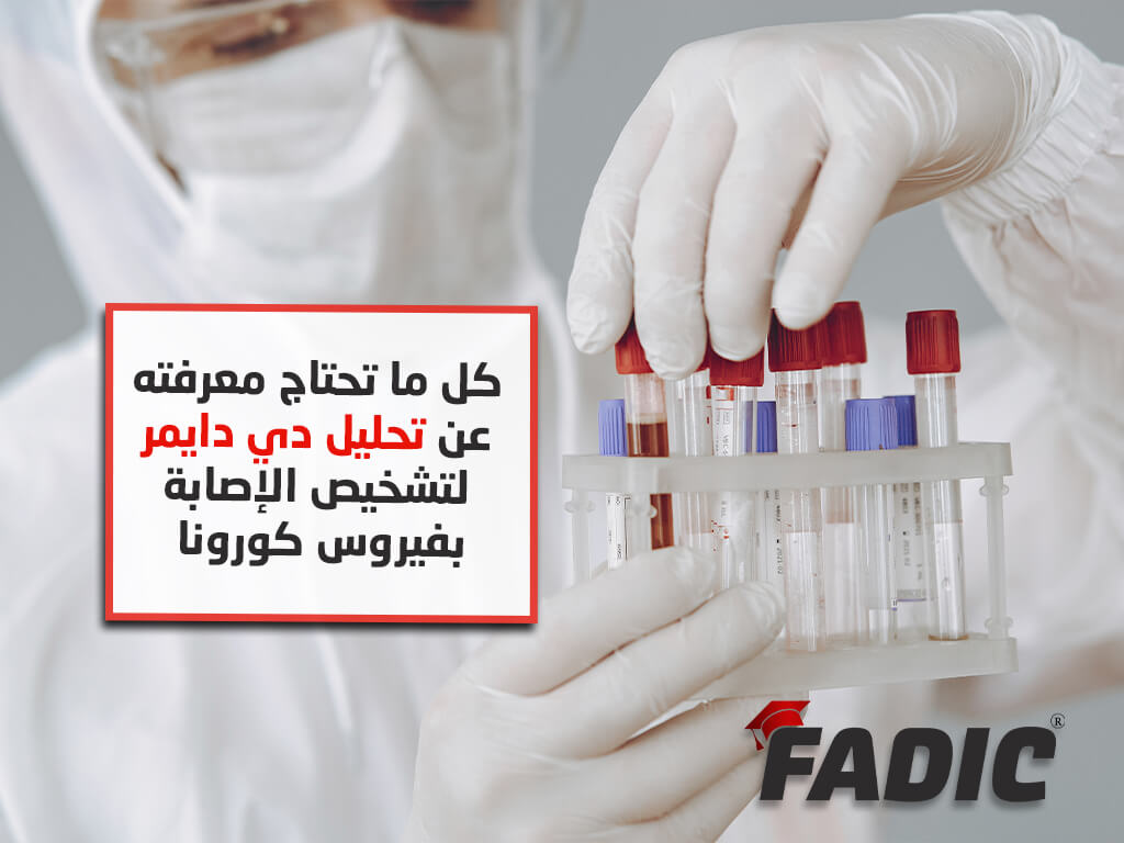 تحليل لتشخيص فيروس كورونا D-dimer test