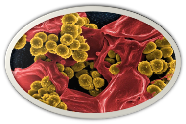 Six Bacteria Cause the Antimicrobial Resistance