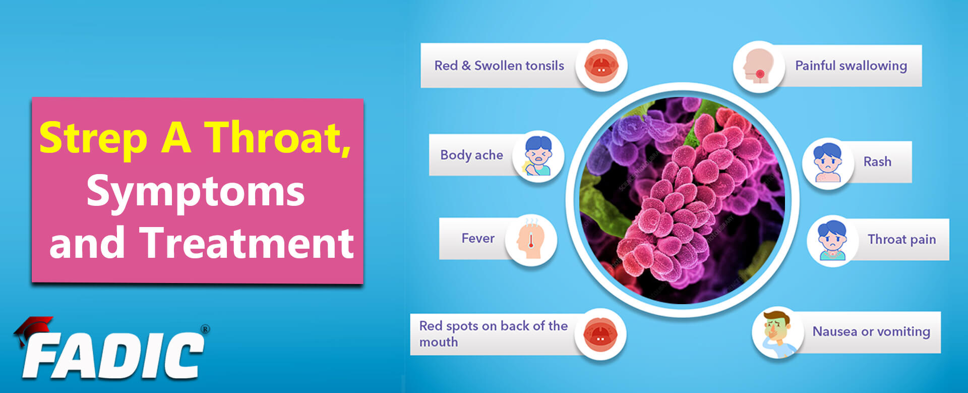 streptococcal-pharyngitis-rash